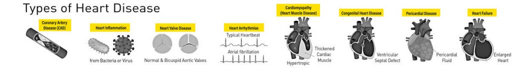 Types of Heart Diseases